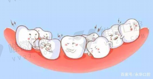 科尔自酸蚀自粘结流体树脂（科尔树脂补牙能用多久）(图1)